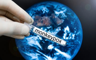 Variole du singe : mobilisation des professionnels de santé